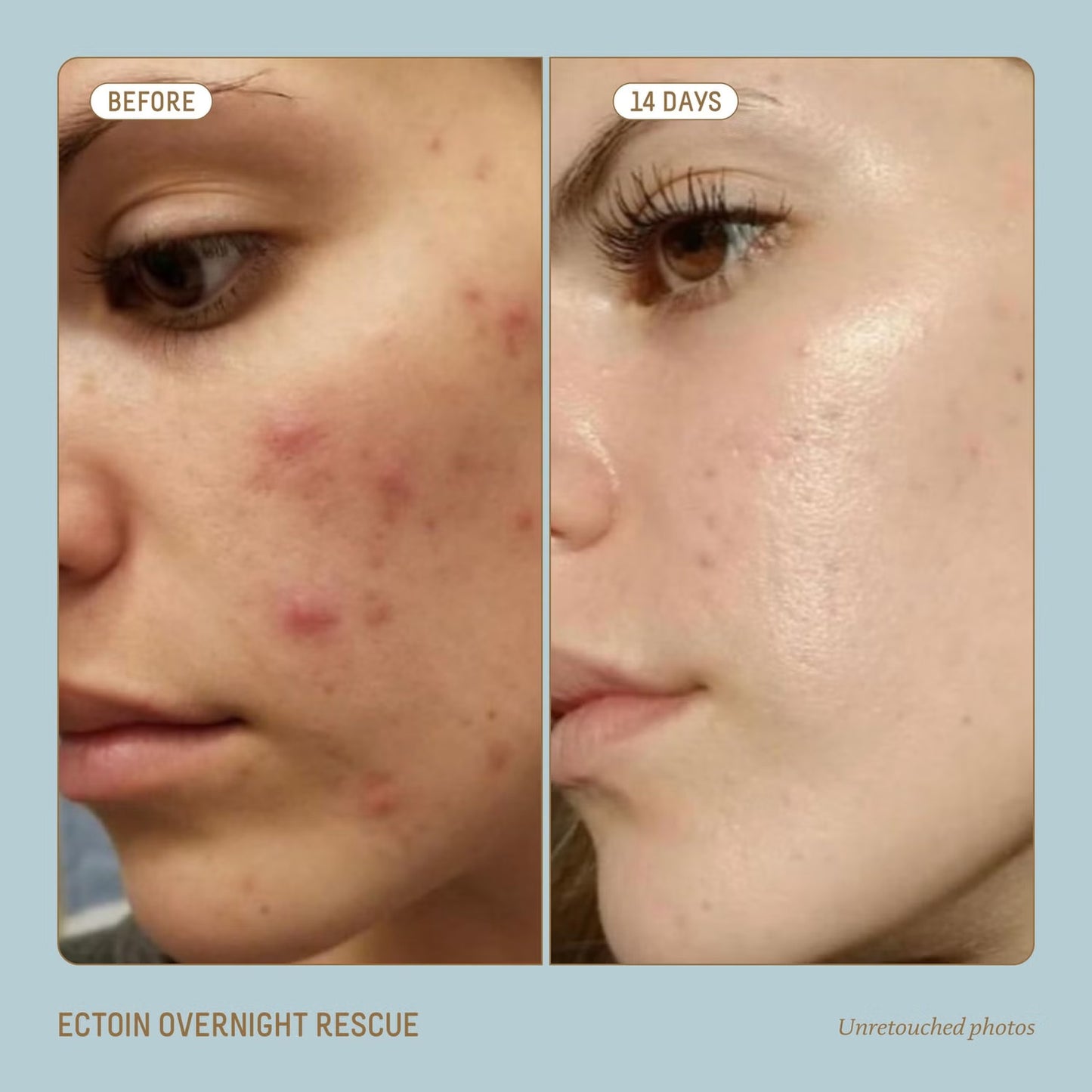 Biossance Squalane and Ectoin Overnight Rescue 50ml